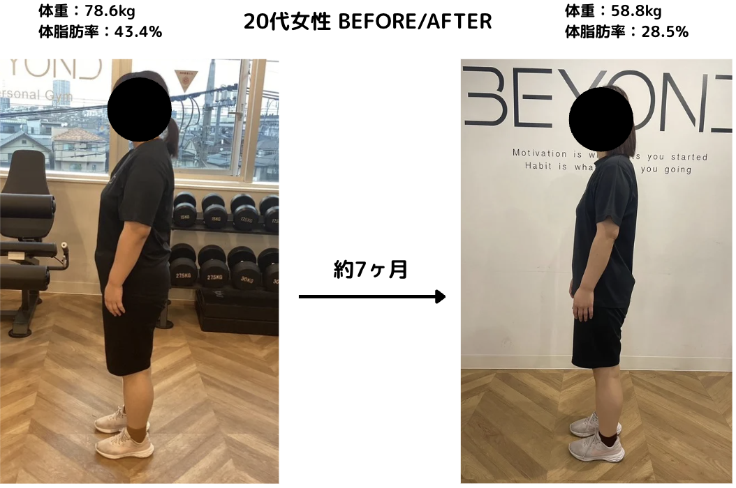 【20代女性のお客様before/after✨】